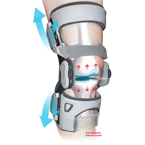 OA Unloading Telescopic Brace, Osteoarthritis Knee, Orthotix